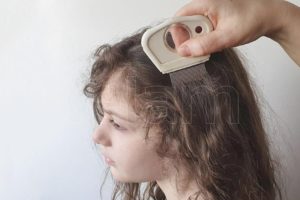 Según un estudio argentino, la pediculosis se redujo de un 70% a un 44% después de la cuarentena