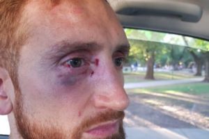 ALEJANDRO REINICK FUE AGREDIDO POR HINCHAS DE PEÑAROL. (CRÉDITOS: @PABLOTOSAL)