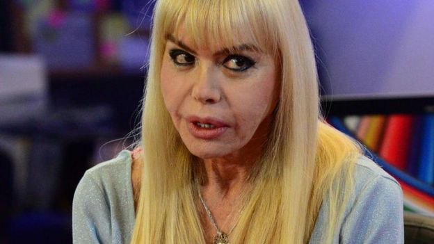 Preocupación por el estado de salud de Adriana Aguirre: “Está muy mal”