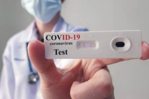 La semana próxima podrían estar a la venta en farmacias los autotest de Covid