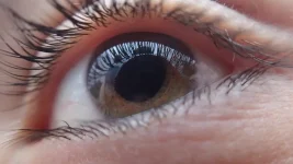 Día Mundial del Glaucoma: ¿Cómo prevenir esta patología?