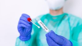 Coronavirus: reportan 3.432 casos y otros 27 muertos en las últimas 24 horas