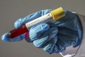 Reportaron hoy 35 nuevos contagios en la ciudad