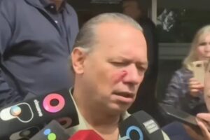 Berni: “¿Cómo voy a renunciar? Lo que tengo que hacer es duplicar los esfuerzos”