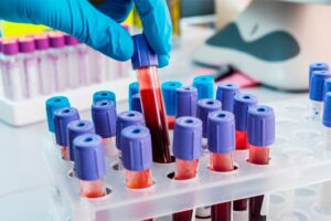 Bioquímicos se suman a los profesionales que cobrarán copagos a afiliados de prepagas