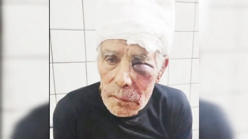 Conmocion por la muerte de un ciclista tras un asalto en Luro al 10.000