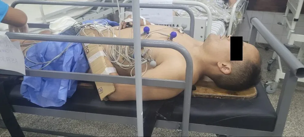 Pareja de mujer policía le fracturó los dos brazos al ladrón que intentó agredirla en Don Bosco al 1100