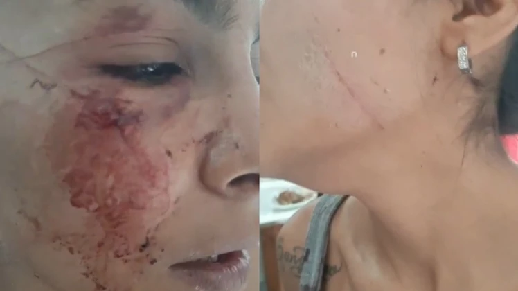 Una joven recibió una brutal golpiza por parte de su grupo de amigas en barrio Jorge Newbery: la acusaron de “infiel”